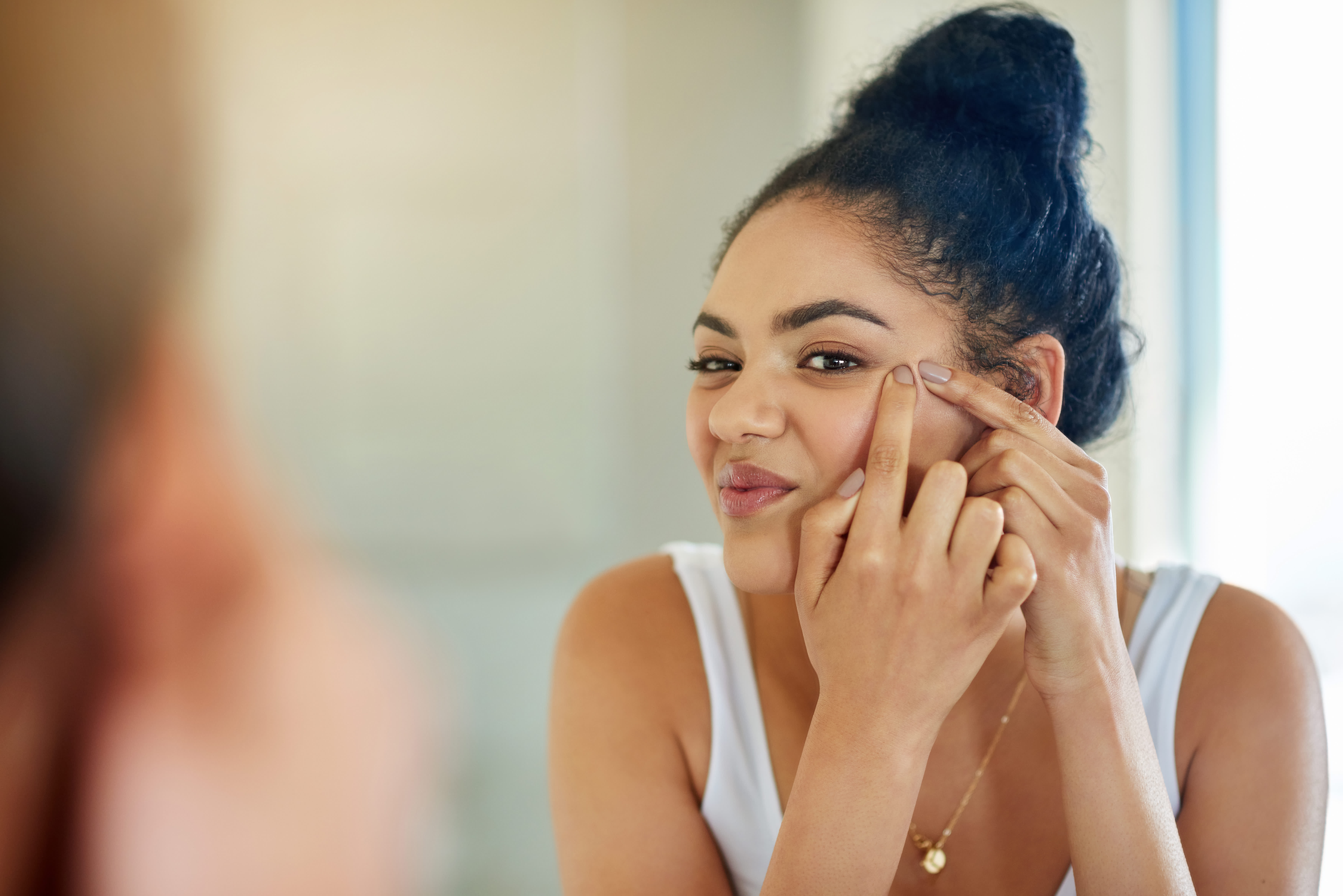 young woman popping a pimple on her face